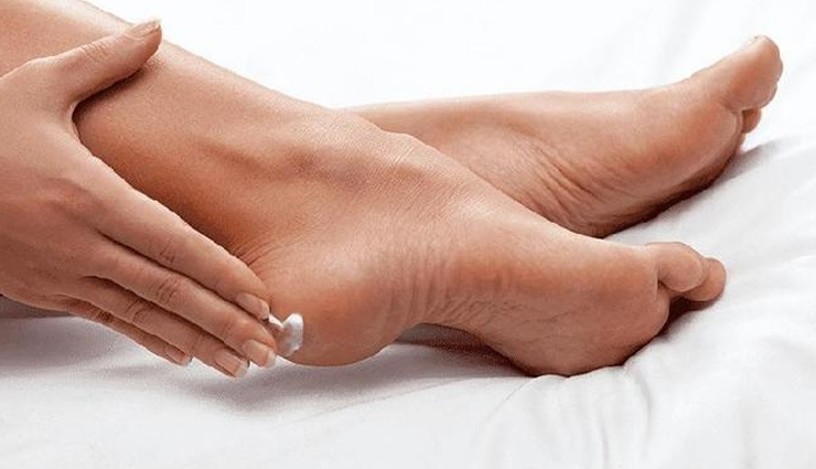 remedies to treat cracked heels,home remedies,cracked heels,skin care tips