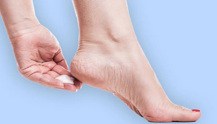 natural ways to treat cracked heels,home remedies,home remedies to treat cracked heels,cracked heels tips,beauty tips,heels care tips,skin care tips