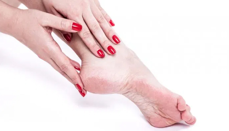 home remedies to treat cracked heels,tips for cracked heels,heels care tips,feet care tips,beauty tips,skin care tips