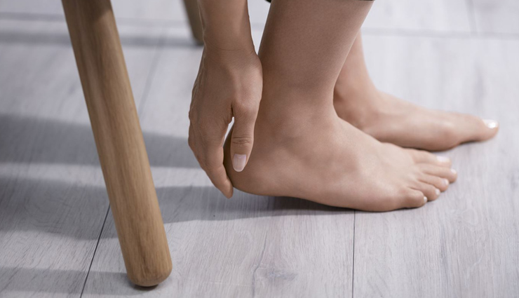 cracked heels,home remedies for cracked heels,heels care tips,beauty tips,skin care tips,home remedies