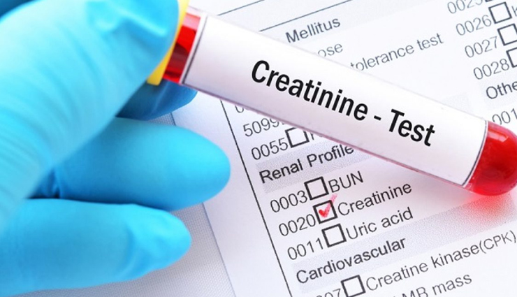किडनी से जुड़ी समस्याएं पैदा कर सकता हैं बढ़ा हुआ क्रिएटिनिन, इन उपायों से करें इसे कम 