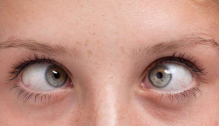 eye problems,eyes care,eye problem,blurred vision,lazy eye,diabetic retinopathy,cataract,glaucoma,blepharitis,crossed eyes,Health