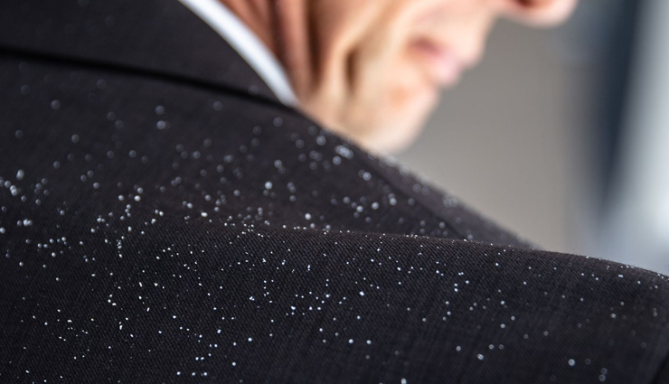 curd for skin and hair,beauty benefits of curd,skin care tips,hair care tips,beauty tips