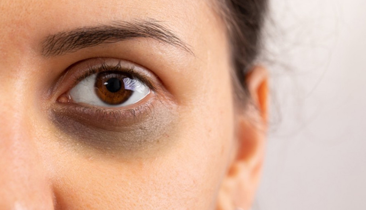 curd for skin and hair,beauty benefits of curd,skin care tips,hair care tips,beauty tips