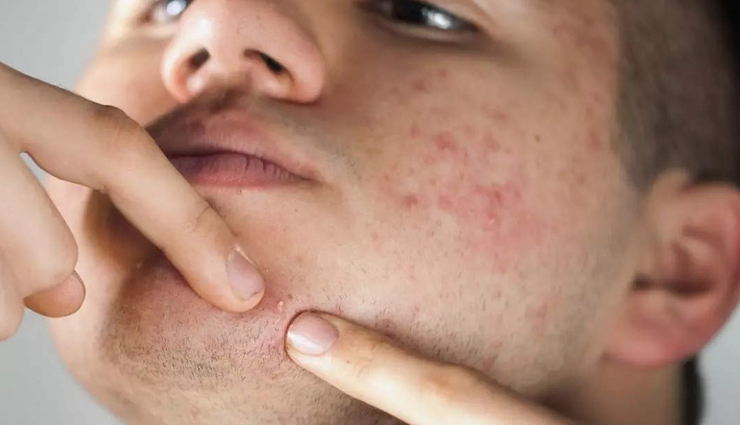 curd for skin and hair,beauty benefits of curd,skin care tips,hair care tips,beauty tips