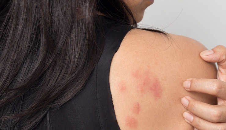 curd for skin and hair,beauty benefits of curd,skin care tips,hair care tips,beauty tips