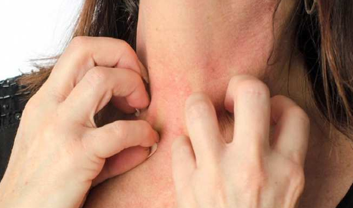 curd that enhances beauty can become fatal for the skin know how,beauty tips,beauty hacks