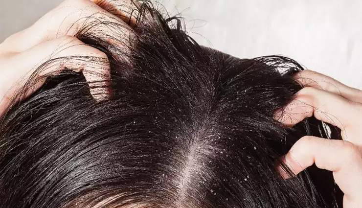 curry leaves,curry leaves for skin,curry leaves for hair,skin care tips,beauty tips,hair care tips