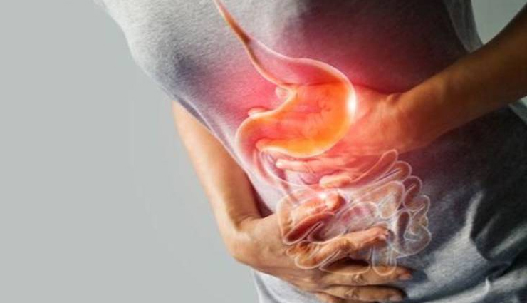 curry leaves,health benefits of curry leaves,Health tips,fitness tips