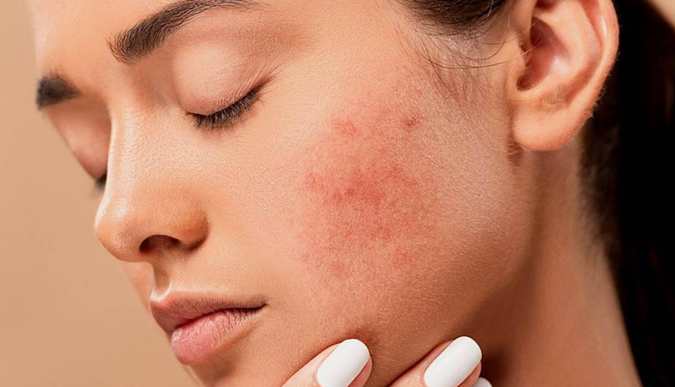 curry leaves health benefits,benefits of eating curry leaves,health advantages of curry leaves,curry leaves nutrition benefits,curry leaves for health and wellness,impact of curry leaves on health,why eat curry leaves for health,curry leaves health-boosting properties