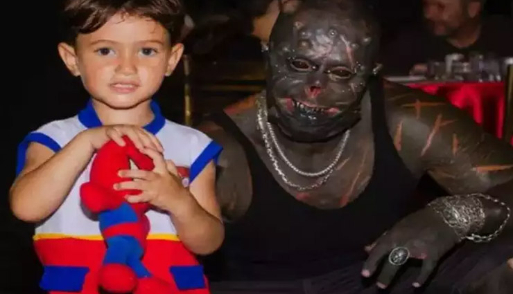 अपनी इस एक खुशी के कारण शख्स ने कटवा दिए अपने दोनों कान ear,cut ear,man cut his ear,weird photos