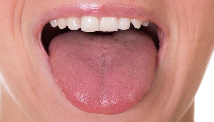 जीभ का जलना और कटना बनता है दुखदायी, ये नुस्खे दिलाएँगे आपको आराम