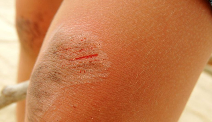 irish moss health benefits,sea moss benefits,health benefits of sea moss,irish moss superfood,benefits of irish moss for skin,irish moss immune system,irish moss digestion,irish moss anti-inflammatory,irish moss vitamins and minerals,irish moss for healthy hair and nails