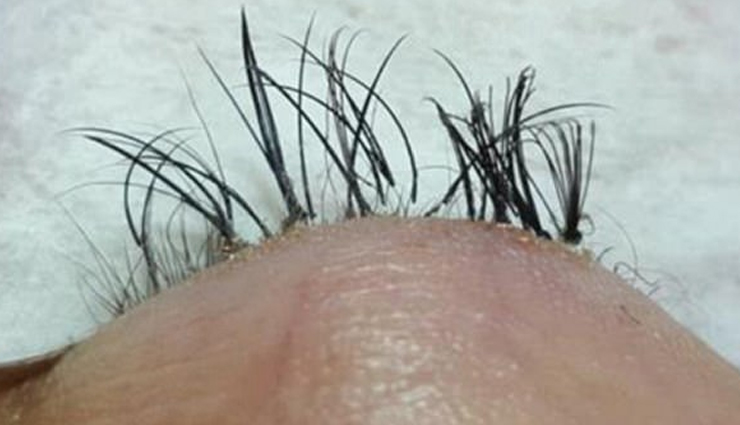 eyelash extension side effects,beware of eyelash extension risks,potential problems with lash extensions,adverse effects of using lash extensions,eyelash extensions and their drawbacks,negative consequences of lash extension use,health concerns with eyelash extensions,side effects of prolonged lash extension use,risks of wearing eyelash extensions,eyelash extension complications to watch out for