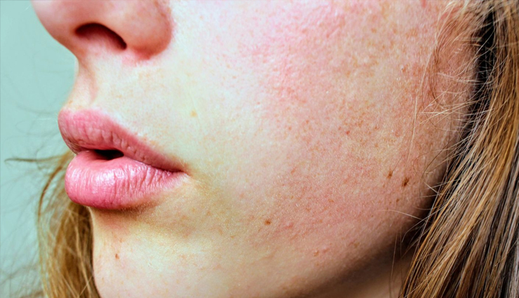 skin whitening,tomato for skin whitening,skin whitening tips,benefits of using tomato for skin,skin care,skin care tips,benefits of tomato for skin