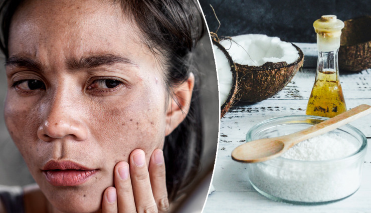 home remedies for skin problems,natural remedies for skin,treat skin issues at home,effective skin care remedies,oily skin treatment,dry skin remedies,anti-aging skin care,pimple and acne treatment,skin burn remedies,blackheads and whiteheads removal,unwanted hair removal,damaged skin healing