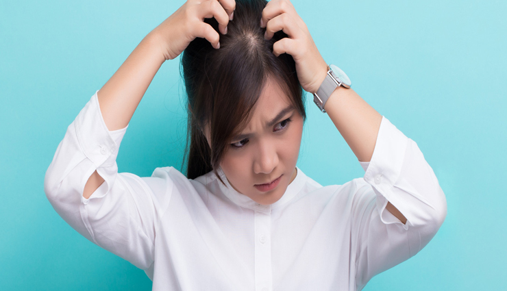 11 Home Remedies To Help You Kick Off Dandruff