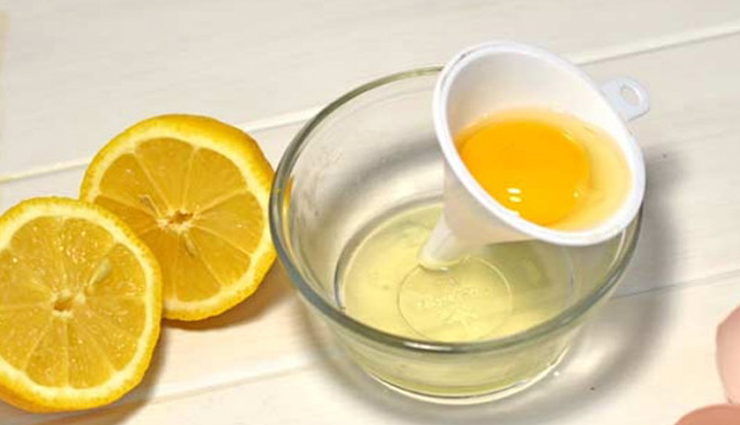 सर्दियां आते ही बढ़ जाती हैं बालों में डैंड्रफ की समस्या, इन उपायों से करें इसे दूर the problem of dandruff in hair increases as soon as winter comes remove it with these measures,beauty tips,beauty hacks