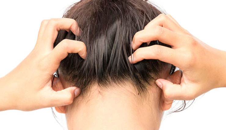 dandruff,major causes of dandruff,hair care tips,beauty tips