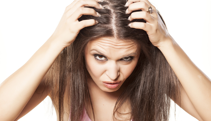 8 Effective Ways to Treat Dandruff Completely