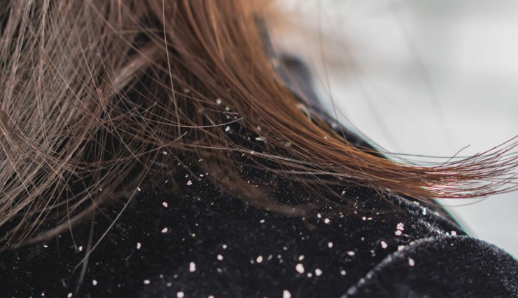 witch hazel for hair,benefits of witch hazel for hair,witch hazel scalp care,witch hazel astringent properties,witch hazel scalp oil balance,witch hazel soothes irritation,witch hazel hair cleansing,witch hazel hair health,witch hazel enhances hair shine,witch hazel reduces dandruff,witch hazel natural hair tonic,diy hair care with witch hazel,alcohol-free witch hazel,witch hazel hair refreshment,witch hazel hair revitalization