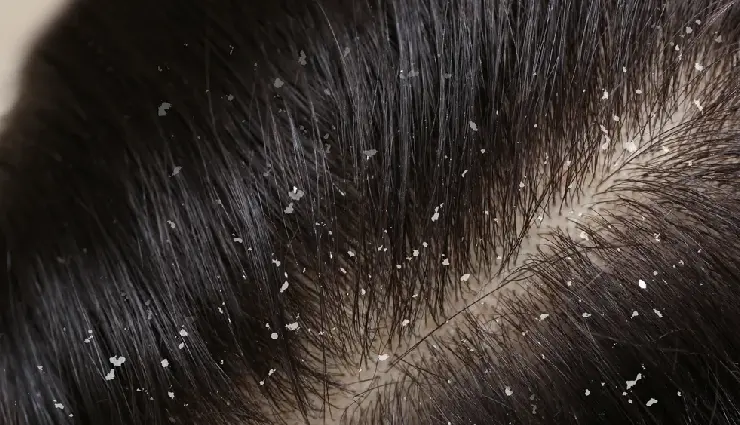 benefits of tomatoes for skin,tomatoes for body care,natural skincare remedies,antioxidant-rich foods,tomatoes for glowing skin,home remedies with tomato,tomato face pack,skincare with tomatoes,vitamin c for skin,natural beauty tips