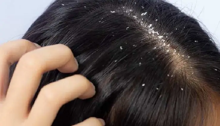 sunflower oil benefits for skin,sunflower oil for hair,sunflower oil uses,vitamin e oil for skin,natural oil for glowing skin,sunflower oil moisturizer,sunflower oil scalp treatment,sunflower oil beauty remedies,non-comedogenic oils,natural skincare oil,hair strengthening oils,sunflower seed oil for beauty,sunflower oil antioxidant benefits