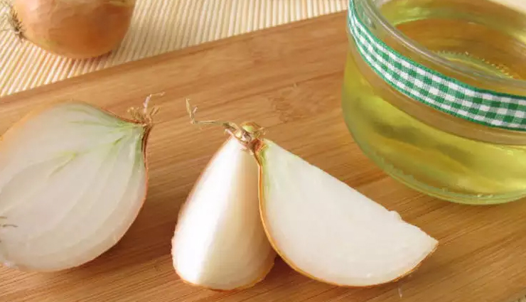 monsoon dandruff,home remedies for monsoon dandruff,hair care tips,beauty tips