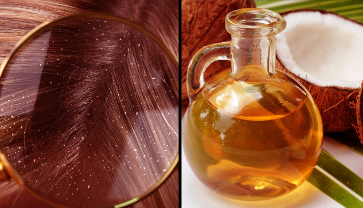 coconut oil,coconut oil for skin,coconut oil for hair,hair and skin benefits,coconut oil beauty benefits,coconut oil hair benefits