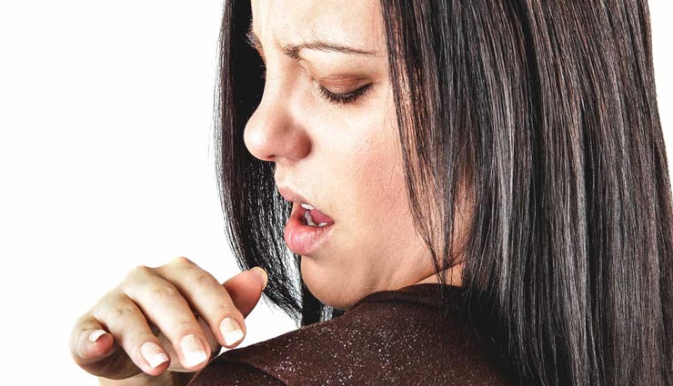 दही का यह हेयर मास्क दिलाएगा बालों में डैंड्रफ की समस्या से छुटकारा, जानें और आजमाए