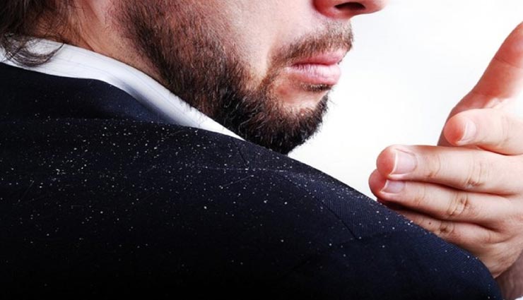 beauty tips,beauty tips in hindi,hair gel,hair care tips,hair gel causing harm hair,hair problems