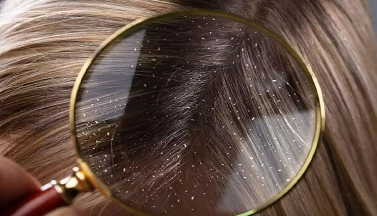 beauty tips,beauty tips in hindi,hair care tips,bay leaf for hair