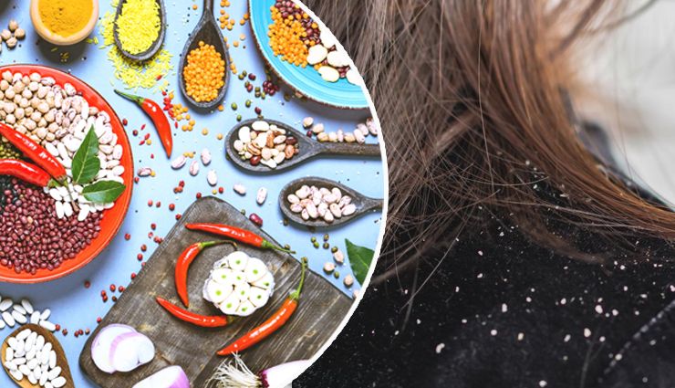 6 Kitchen Ingredients That Will Help you Get Rid of Dandruff