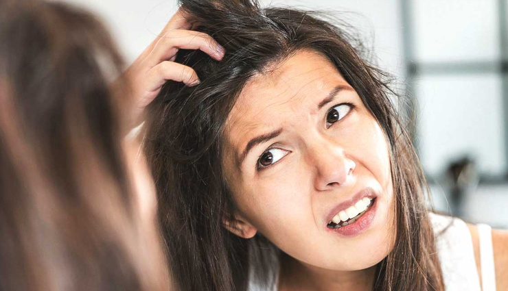Get Rid of Dandruff Permanently WIth These Effective Remedies