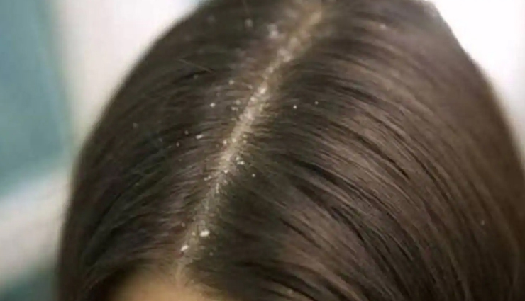 castor oil,benefits of castor oil,castor oil health benefits,health benefits of castor oil,Health,Health tips,healthy food