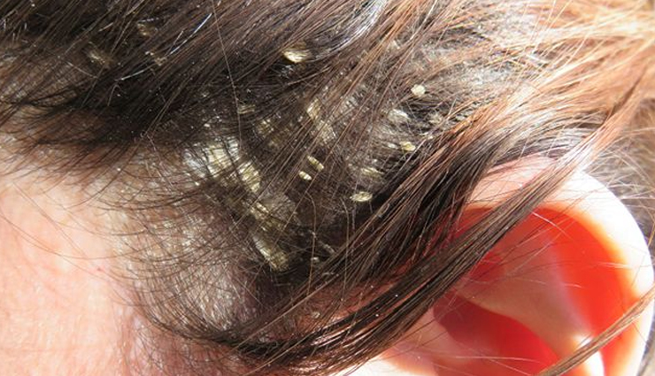 cinnamon oil,cinnamon oil benefits,cinnamon oil hair benefits,cinnamon oil for healthy hair,hair,hair care tips,healthy hair tips,beauty,beauty tips