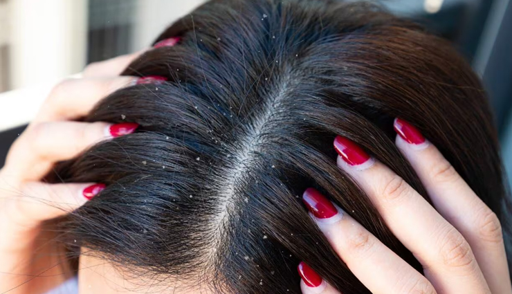 बालों के लिए वरदान साबित होगा भृंगराज तेल, जानें इसके फायदे, बनाने और लगाने का तरीका bhringraj oil for hair growth,benefits of bhringraj oil for hair,bhringraj oil for hair fall,uses of bhringraj oil for hair,bhringraj oil for scalp health,how bhringraj oil promotes hair growth,bhringraj oil for hair thinning,bhringraj oil for dandruff,bhringraj oil for hair regrowth,bhringraj oil for hair strengthening,bhringraj oil for hair damage repair,bhringraj oil for hair texture improvement,natural hair care with bhringraj oil,bhringraj oil for long and healthy hair,ayurvedic benefits of bhringraj oil for hair