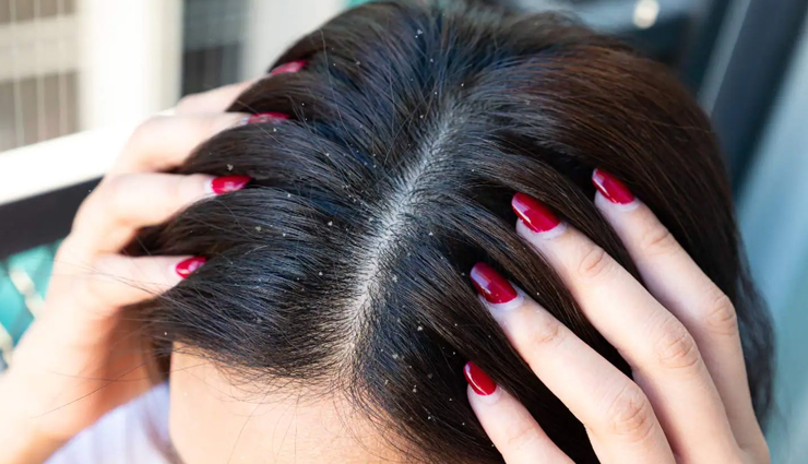 clove oil for hair growth,benefits of clove oil for hair,clove oil hair care tips,clove oil and hair health,clove oil for dandruff control,using clove oil for hair strengthening,clove oil for scalp health,clove oil for hair shine,clove oil for hair loss prevention,clove oil hair treatment,natural hair remedies with clove oil,clove oil for split ends,clove oil hair mask benefits,clove oil for hair thickening,clove oil and hair follicle stimulation,clove oil for itchy scalp relief,diy clove oil hair treatments,clove oil and hair repair,clove oil for frizz control,clove oil and hair care secrets