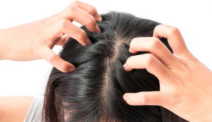 home remedies for dandruff,tips to treat dandruff,hair care tips,beauty tips