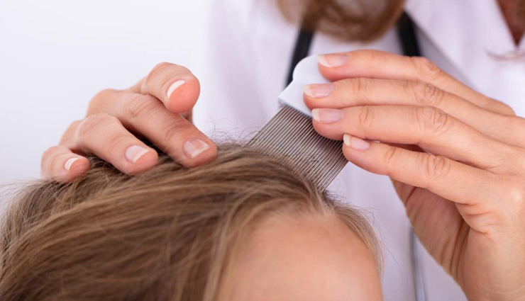 myths about dandruff,dandruff misconceptions,dandruff causes,how to treat dandruff,dandruff and hygiene,dandruff in men and women,dandruff and diet,seasonal dandruff,over-the-counter dandruff treatment,dandruff skin care tips