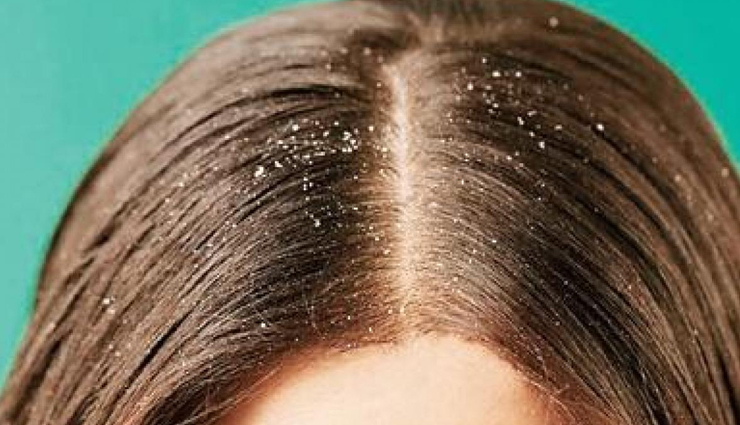 beauty benefits of multani mitti,beauty tips,beauty hacks