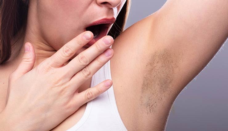 remedies to lighten dark armpits,home remedies,remedies for dark armpits,skin care tips,beauty tips