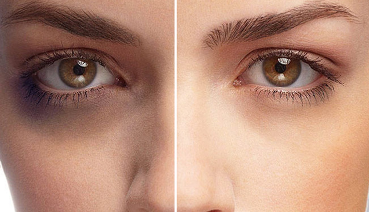 थकान दूर करने के साथ ही चेहरे को ग्लो देने का काम करेगा बर्फ, जानें इसके फायदे ice,benefits of ice on face,ice on face,benefits of applying ice on face,skin care tips,skin care,beauty,beauty tips