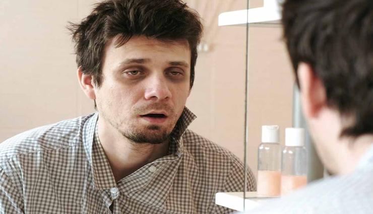 आंखों के नीचे बने काले घेरे घटा रहे चहरे का आकर्षण, मददगार साबित होंगे ये टिप्स 