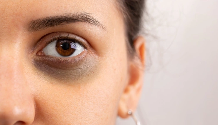 beetroot for skin,beetroot benefits for skin,beetroot for glowing skin,beetroot for acne,beetroot for pigmentation,beetroot for anti-aging,beetroot for skin whitening,beetroot face pack,beetroot for skin care,beetroot for healthy skin