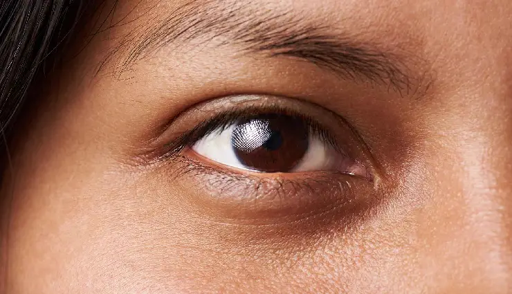 10 Effective Home Remedies To Treat Dark Circles