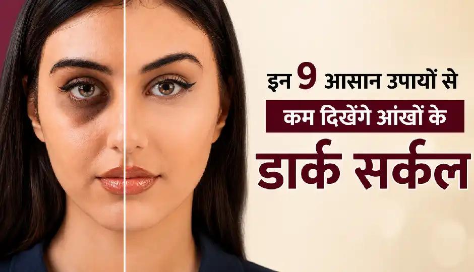 मेकअप से नहीं, इन 9 आसान उपायों से कम दिखेंगे आंखों के डार्क सर्कल
