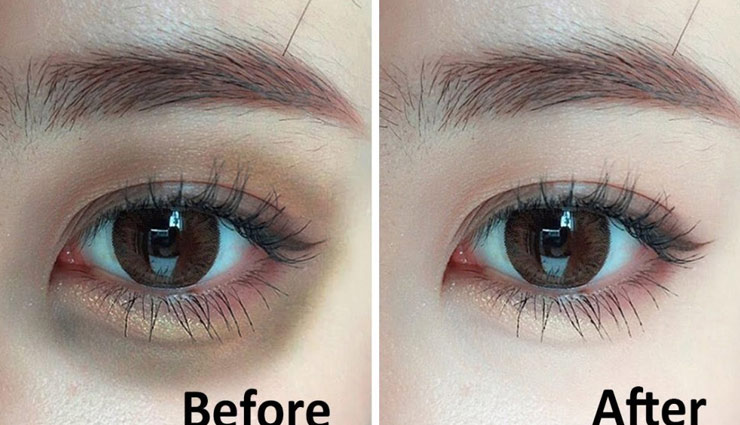 आँखों के नीचे काले घेरे घटाते है सुंदरता, दूर करें इन तरीको से 