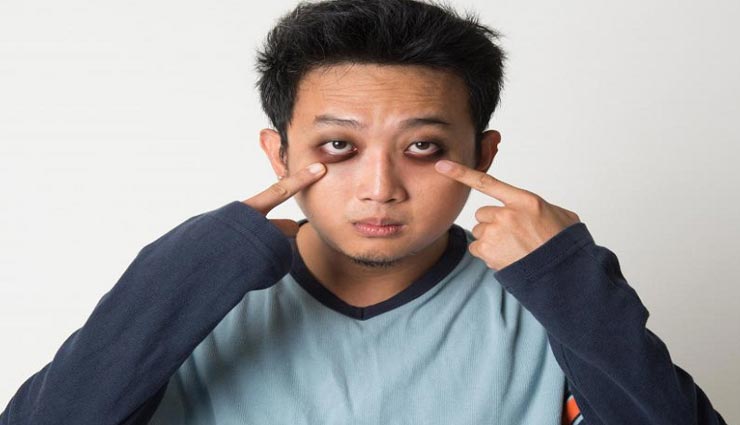 आजमाइए आई मास्क के ये प्राकृतिक तरीके, मिलेगा डार्क सर्कल से जल्द छुटकारा