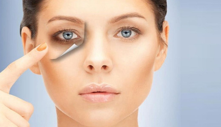 5 Ways To Treat Dark Circle at Home